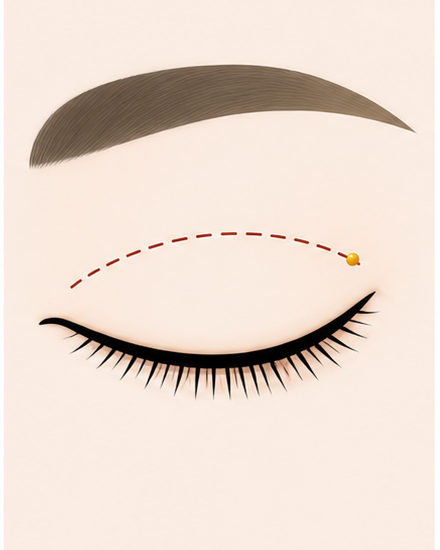 Procedure stage visual 02