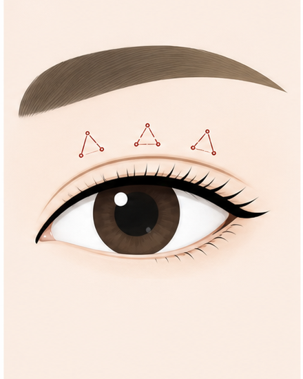 Procedure stage visual 03